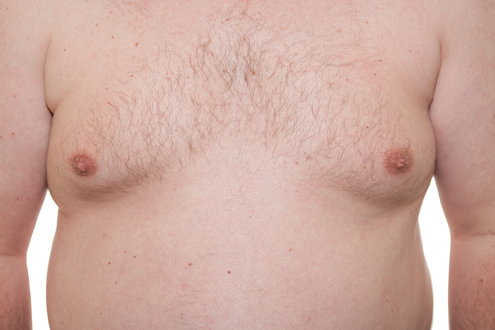 Overweight man has enlarged chest due to fat. Overweight man has enlarged chest due to fat.
